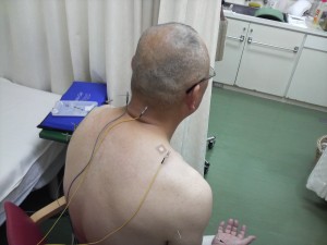 針治療風景1.