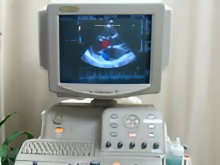 超音波検査室